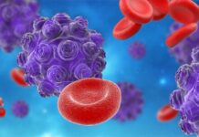 Turista con sarampión desata alarma en condados King y Snohomish Ilustración 3D del virus del sarampión (en púrpura) junto a glóbulos rojos en el plasma sanguíneo.