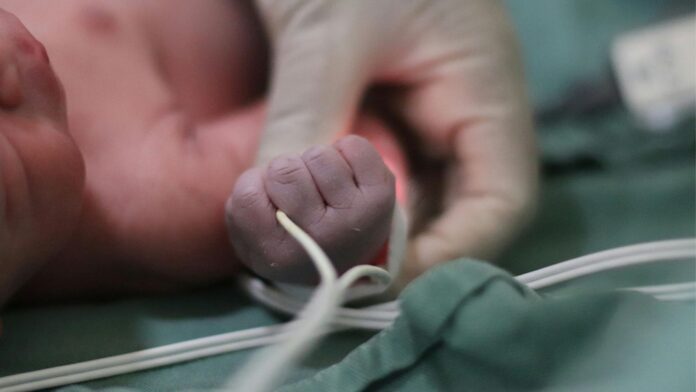 A newborn baby is being held by a doctor