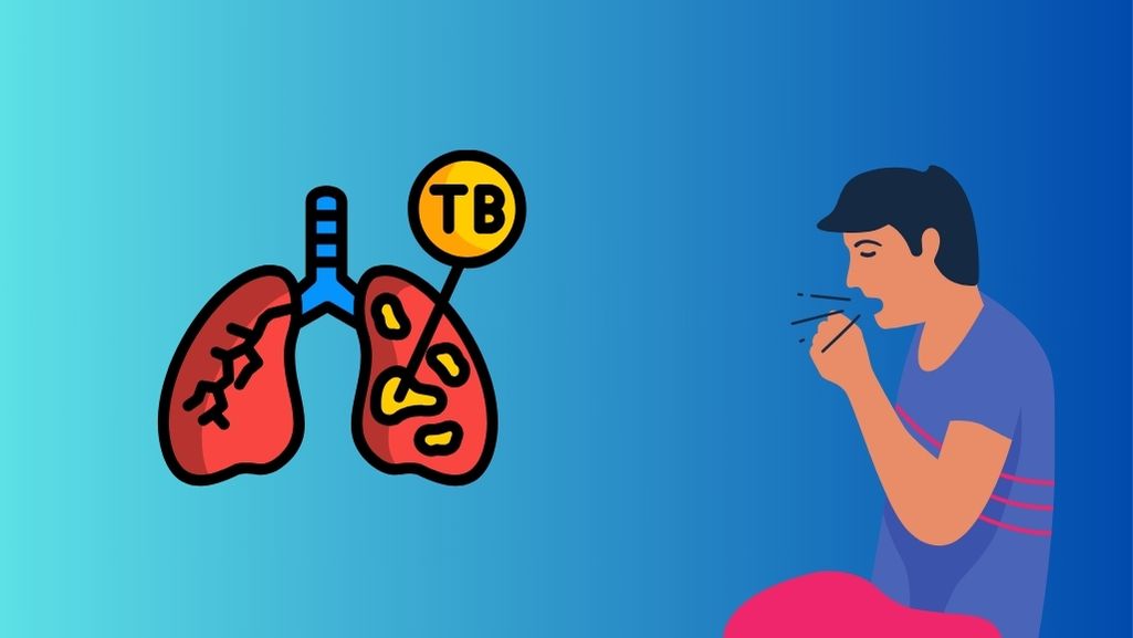 Ilustración comparativa de dos pulmones, uno sano y otro con áreas amarillas marcadas como TB que representan la infección, junto a una persona tosiendo para mostrar la transmisión aérea de la tuberculosis.