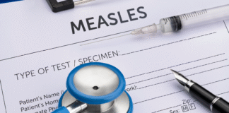El departamento de salud de Washington lanza un mapa de exposición al sarampión