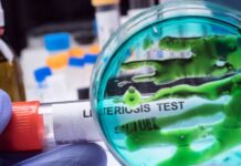 Seis muertes por brote de listeria vinculado a pastas preparadas