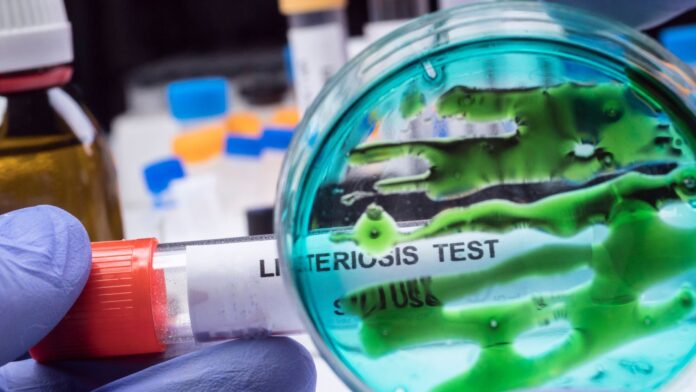 General Leo 2 - 2025-11-03T180137.940