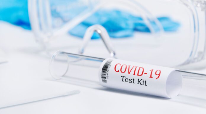 Estudio revela alta incidencia de COVID prolongado en hispanos de Washington