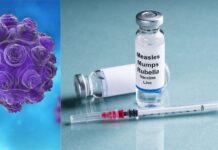 Confirman tres nuevos casos de sarampión en menores del condado Snohomish