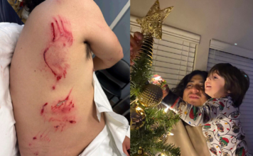 Liberan a hombre herido por un perro de ICE durante su arresto en Vancouver A la izquierda algunas de las lesiones sufridas por Wilmer Toledo Martínez tras el ataque de un perro de ICE durante su detención y a la derecha se observa a Wilmer Toledo-Martínez con uno de sus hijos colocando la estrella en el árbol de navidad - Cortesía de la senadora Patty Murray