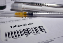 Unas 130 personas vinculadas a la escuela Rainier Beach deberían realizarse la prueba de tuberculosis