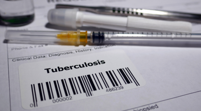 Unas 130 personas vinculadas a la escuela Rainier Beach deberían realizarse la prueba de tuberculosis