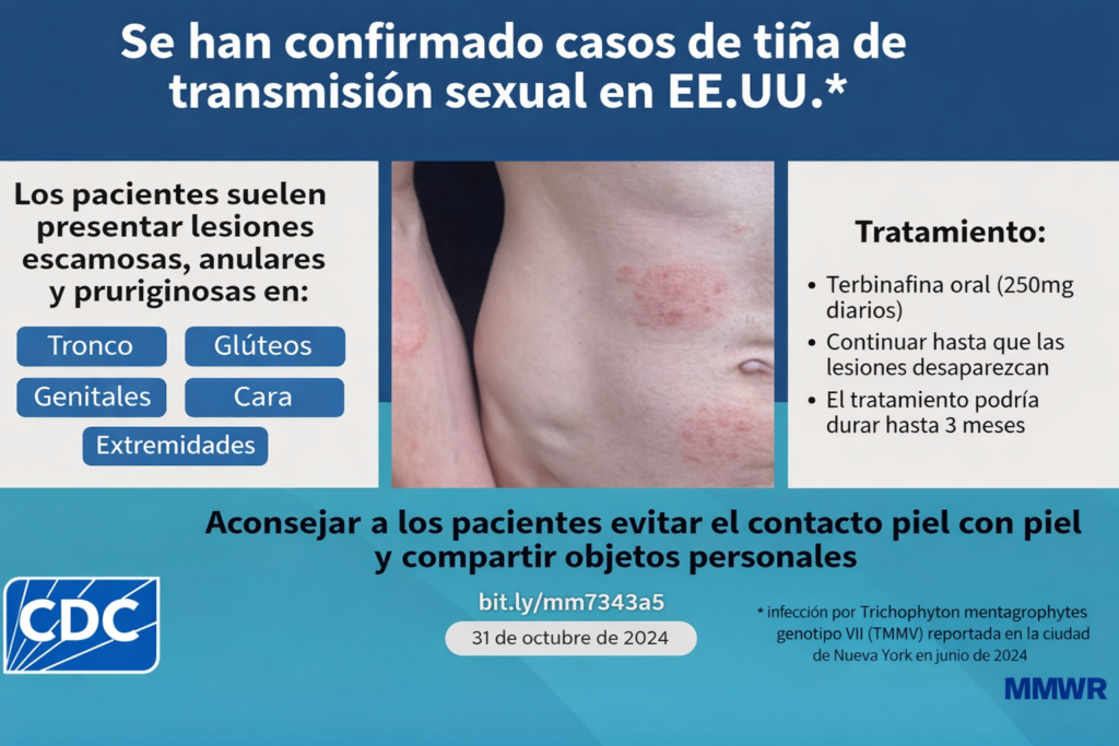 Autoridades de salud advierten sobre casos de tiña de transmisión sexual en EE.UU.; los pacientes presentan lesiones escamosas y deben evitar el contacto piel con piel y compartir objetos personales — Foto: CDC 