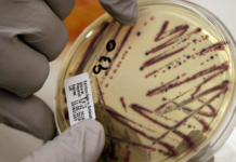 Autoridades sanitarias de EEUU vinculan brote de intoxicación alimentaria a germinado de alfalfa ARCHIVO - Un microbiólogo señala un cultivo aislado de E. coli en una placa de agar en el Departamento de Salud del Estado de Washington, el 3 de noviembre de 2015.