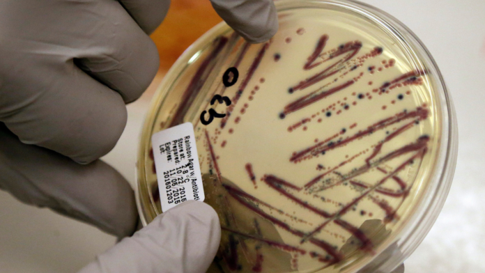 ARCHIVO - Un microbiólogo señala un cultivo aislado de E. coli en una placa de agar en el Departamento de Salud del Estado de Washington, el 3 de noviembre de 2015.