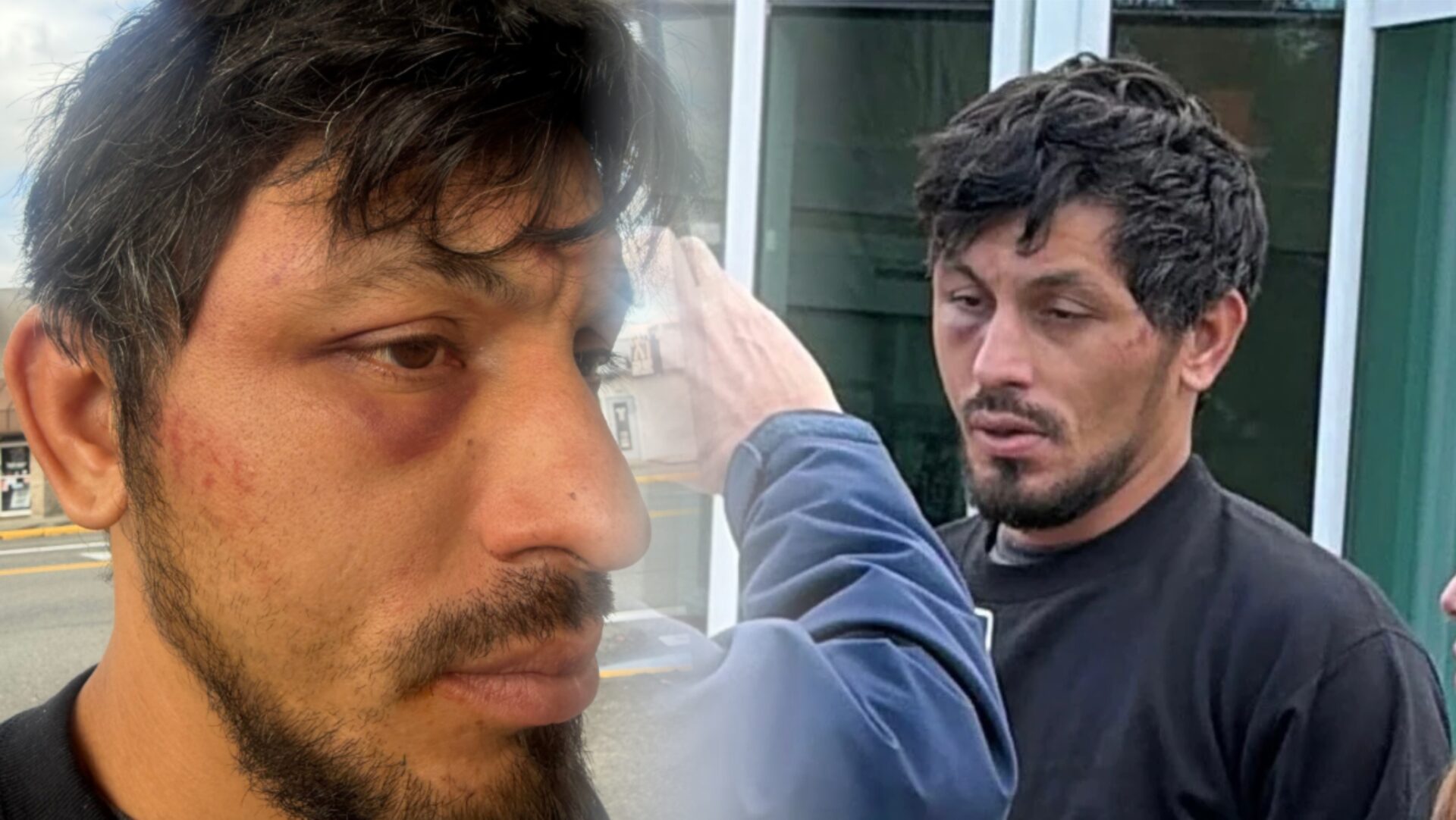 Collage de dos fotografías de Mauro Alberto Félix después de salir en libertad bajo fianza en Auburn, Washington. Las imágenes muestran moretones e hinchazón alrededor de uno de sus ojos y marcas visibles en el rostro.